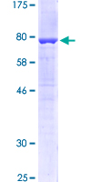 KRT6A / CK6A / Cytokeratin 6A Protein - 12.5% SDS-PAGE of human KRT6A stained with Coomassie Blue