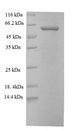 KRT6A / CK6A / Cytokeratin 6A Protein - (Tris-Glycine gel) Discontinuous SDS-PAGE (reduced) with 5% enrichment gel and 15% separation gel.