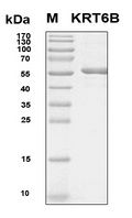 KRT6B / CK6B / Cytokeratin 6B Protein
