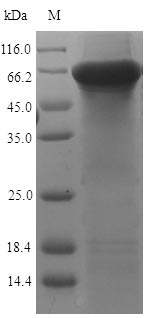 KRT7 / CK7 / Cytokeratin 7 Protein - (Tris-Glycine gel) Discontinuous SDS-PAGE (reduced) with 5% enrichment gel and 15% separation gel.