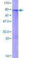 KRT7 / CK7 / Cytokeratin 7 Protein - 12.5% SDS-PAGE of human KRT7 stained with Coomassie Blue