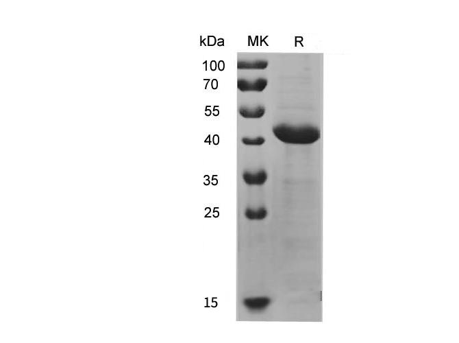 KRT7 / CK7 / Cytokeratin 7 Protein - Recombinant Human KRT7 Protein (His Tag)-Elabscience