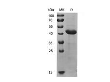 KRT7 / CK7 / Cytokeratin 7 Protein - Recombinant Human KRT7 Protein (His Tag)-Elabscience