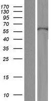 KRT71 / Keratin 71 Protein - Western validation with an anti-DDK antibody * L: Control HEK293 lysate R: Over-expression lysate