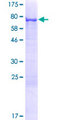 KRT71 / Keratin 71 Protein - 12.5% SDS-PAGE of human KRT71 stained with Coomassie Blue