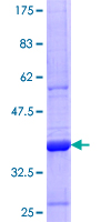KRT71 / Keratin 71 Protein - 12.5% SDS-PAGE Stained with Coomassie Blue.