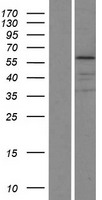 KRT75 / Keratin 75 / K6HF Protein - Western validation with an anti-DDK antibody * L: Control HEK293 lysate R: Over-expression lysate