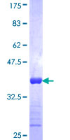 KRT75 / Keratin 75 / K6HF Protein - 12.5% SDS-PAGE Stained with Coomassie Blue.