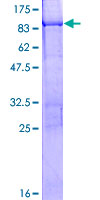 KRT76 / Keratin 76 Protein - 12.5% SDS-PAGE of human KRT76 stained with Coomassie Blue