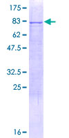 KRT79 / Keratin 79 Protein - 12.5% SDS-PAGE of human KRT79 stained with Coomassie Blue