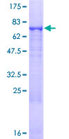 KRT8 / CK8 / Cytokeratin 8 Protein - 12.5% SDS-PAGE of human KRT8 stained with Coomassie Blue