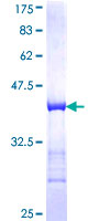 KRT8 / CK8 / Cytokeratin 8 Protein - 12.5% SDS-PAGE Stained with Coomassie Blue.