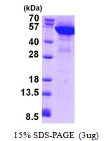 KRT8 / CK8 / Cytokeratin 8 Protein