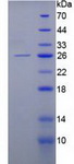 KRT8 / CK8 / Cytokeratin 8 Protein - Recombinant Keratin 8 By SDS-PAGE