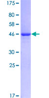 KRT81 / Keratin 81 / KRTHB1 Protein - 12.5% SDS-PAGE of human KRTHB1 stained with Coomassie Blue