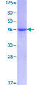 KRT81 / Keratin 81 / KRTHB1 Protein - 12.5% SDS-PAGE of human KRTHB1 stained with Coomassie Blue