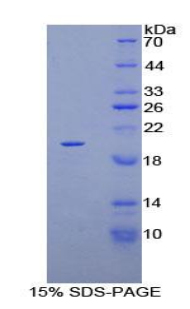 KRT81 / Keratin 81 / KRTHB1 Protein - Recombinant Keratin 81 By SDS-PAGE
