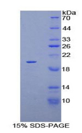 KRT81 / Keratin 81 / KRTHB1 Protein - Recombinant Keratin 81 By SDS-PAGE