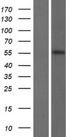 KRT82 / Keratin 82 / KRTHB2 Protein - Western validation with an anti-DDK antibody * L: Control HEK293 lysate R: Over-expression lysate