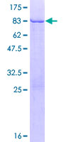 KRT83 / Keratin 83 / KRTHB3 Protein - 12.5% SDS-PAGE of human KRT83 stained with Coomassie Blue