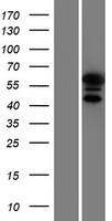 KRT9 / CK9 / Cytokeratin 9 Protein - Western validation with an anti-DDK antibody * L: Control HEK293 lysate R: Over-expression lysate