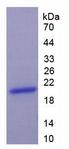 KRT9 / CK9 / Cytokeratin 9 Protein - Recombinant Keratin 9 By SDS-PAGE