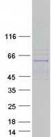 KRT9 / CK9 / Cytokeratin 9 Protein - Purified recombinant protein KRT9 was analyzed by SDS-PAGE gel and Coomassie Blue Staining