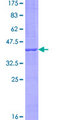 KRTAP1-5 Protein - 12.5% SDS-PAGE of human KRTAP1-5 stained with Coomassie Blue