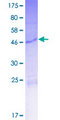 KRTAP10-2 Protein - 12.5% SDS-PAGE of human KRTAP10-2 stained with Coomassie Blue