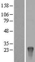 KRTAP10-8 Protein - Western validation with an anti-DDK antibody * L: Control HEK293 lysate R: Over-expression lysate