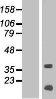 KRTAP13-4 Protein - Western validation with an anti-DDK antibody * L: Control HEK293 lysate R: Over-expression lysate