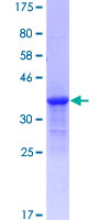 KRTAP17-1 Protein - 12.5% SDS-PAGE of human KRTAP17-1 stained with Coomassie Blue