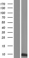 KRTAP21-1 Protein - Western validation with an anti-DDK antibody * L: Control HEK293 lysate R: Over-expression lysate