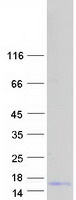 KRTAP3-2 Protein - Purified recombinant protein KRTAP3-2 was analyzed by SDS-PAGE gel and Coomassie Blue Staining