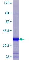 KRTAP3-3 Protein - 12.5% SDS-PAGE of human KRTAP3-3 stained with Coomassie Blue