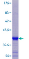 KRTAP3-3 Protein - 12.5% SDS-PAGE of human KRTAP3-3 stained with Coomassie Blue