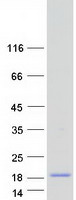 KRTAP3-3 Protein - Purified recombinant protein KRTAP3-3 was analyzed by SDS-PAGE gel and Coomassie Blue Staining