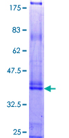 KRTAP4-4 Protein - 12.5% SDS-PAGE of human KRTAP4-4 stained with Coomassie Blue