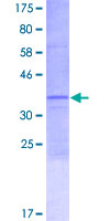 KRTAP5-7 Protein - 12.5% SDS-PAGE of human KRTAP5-7 stained with Coomassie Blue