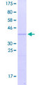 KRTAP9-8 Protein - 12.5% SDS-PAGE of human KRTAP9-8 stained with Coomassie Blue
