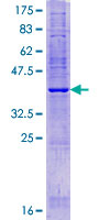KRTCAP2 Protein - 12.5% SDS-PAGE of human KRTCAP2 stained with Coomassie Blue