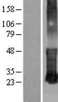 KRTCAP3 Protein - Western validation with an anti-DDK antibody * L: Control HEK293 lysate R: Over-expression lysate