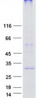 KRTCAP3 Protein - Purified recombinant protein KRTCAP3 was analyzed by SDS-PAGE gel and Coomassie Blue Staining