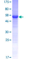 KSP32 / MIOX Protein - 12.5% SDS-PAGE of human MIOX stained with Coomassie Blue
