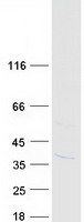 KSP32 / MIOX Protein - Purified recombinant protein MIOX was analyzed by SDS-PAGE gel and Coomassie Blue Staining