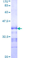 KSR1 Protein - 12.5% SDS-PAGE Stained with Coomassie Blue.