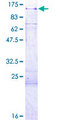 KSR2 Protein - 12.5% SDS-PAGE of human KSR2 stained with Coomassie Blue