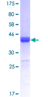 KSR2 Protein - 12.5% SDS-PAGE Stained with Coomassie Blue.