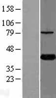 KTI12 Protein - Western validation with an anti-DDK antibody * L: Control HEK293 lysate R: Over-expression lysate