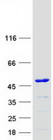 KTI12 Protein - Purified recombinant protein KTI12 was analyzed by SDS-PAGE gel and Coomassie Blue Staining